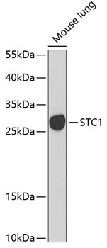 STC1 Rabbit Polyclonal Antibody