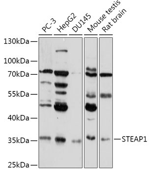 STEAP1 Rabbit Polyclonal Antibody