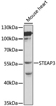 STEAP3 Rabbit Polyclonal Antibody