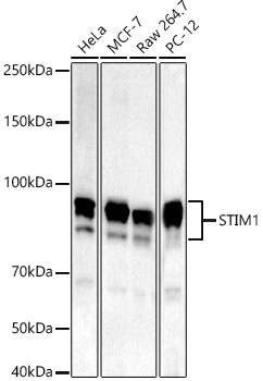 STIM1 Rabbit Monoclonal Antibody