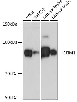 STIM1 Rabbit Monoclonal Antibody - Image 2