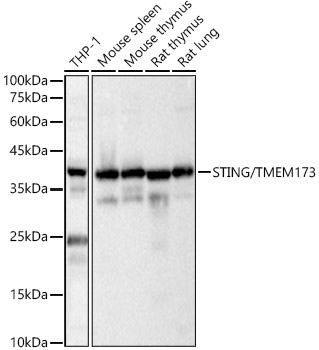 STING/TMEM173 Rabbit Polyclonal Antibody