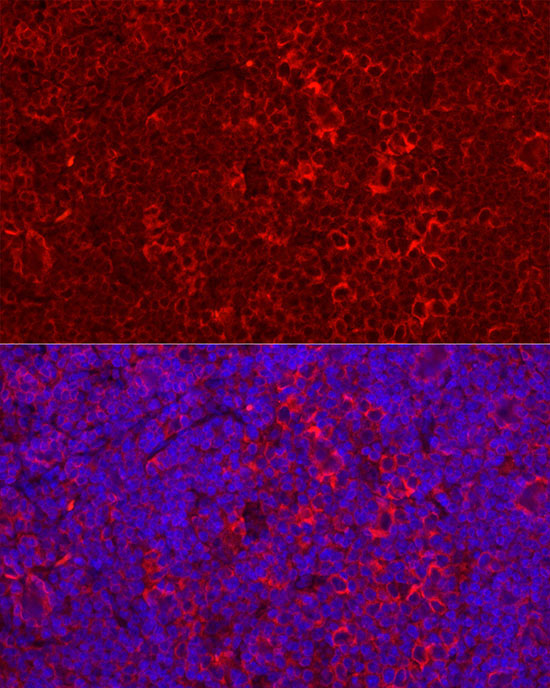 STING/TMEM173 Rabbit Polyclonal Antibody - Image 3