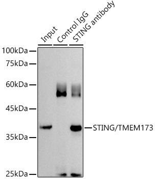 STING/TMEM173 Rabbit Polyclonal Antibody - Image 4