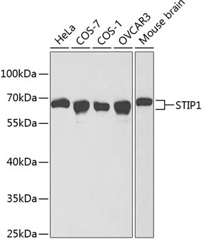 STIP1 Rabbit Polyclonal Antibody