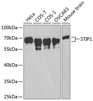 STIP1 Rabbit Polyclonal Antibody