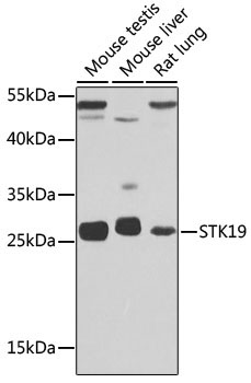 STK19 Rabbit Polyclonal Antibody