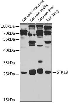 STK19 Rabbit Polyclonal Antibody