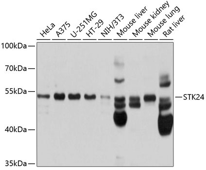 STK24 Rabbit Polyclonal Antibody