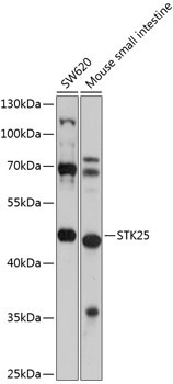 STK25 Rabbit Polyclonal Antibody