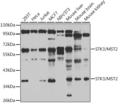 STK3/MST2 Rabbit Polyclonal Antibody