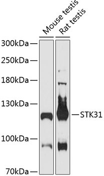 STK31 Rabbit Polyclonal Antibody