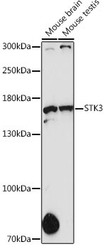 STK36 Rabbit Polyclonal Antibody