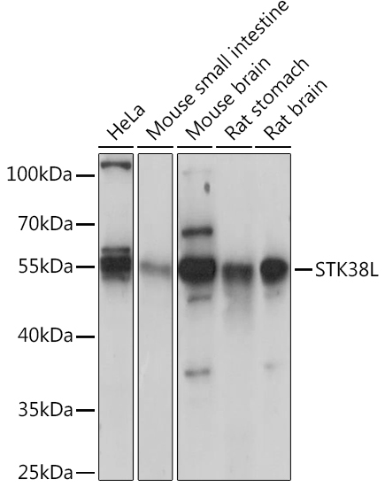 STK38L Rabbit Polyclonal Antibody