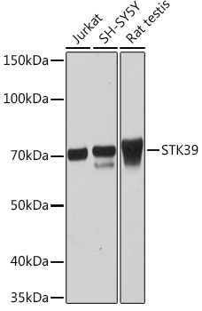 STK39 Rabbit Monoclonal Antibody