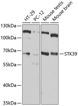 STK39 Rabbit Polyclonal Antibody