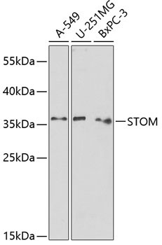STOM Rabbit Polyclonal Antibody