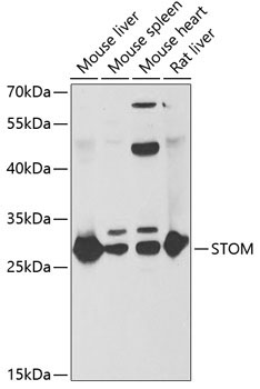 STOM Rabbit Polyclonal Antibody