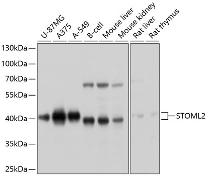 STOML2 Rabbit Polyclonal Antibody