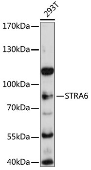 STRA6 Rabbit Polyclonal Antibody