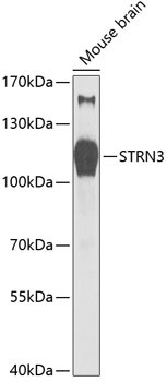 STRN3 Rabbit Polyclonal Antibody