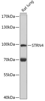 STRN4 Rabbit Polyclonal Antibody