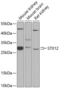 STX12 Rabbit Polyclonal Antibody