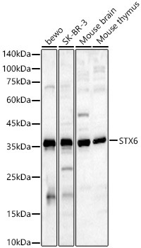 STX6 Rabbit Polyclonal Antibody