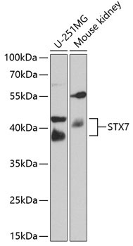 STX7 Rabbit Polyclonal Antibody