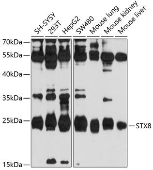 STX8 Rabbit Polyclonal Antibody