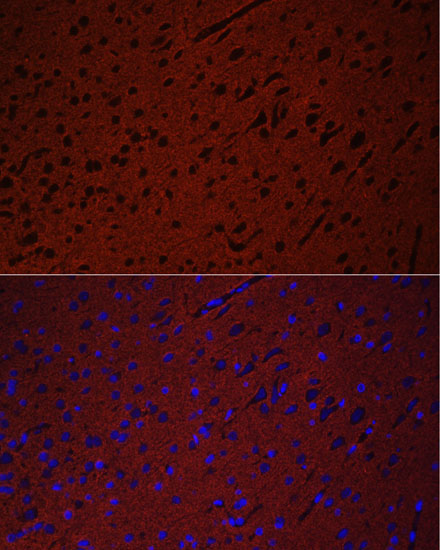 STXBP1 Rabbit Polyclonal Antibody