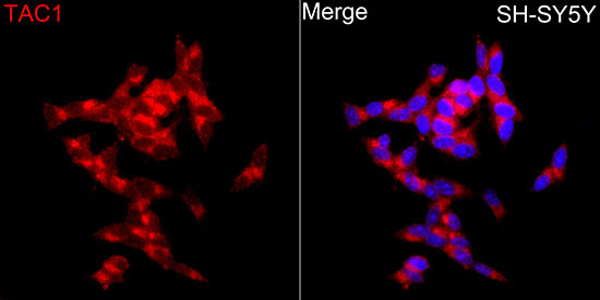 Substance P Rabbit Polyclonal Antibody