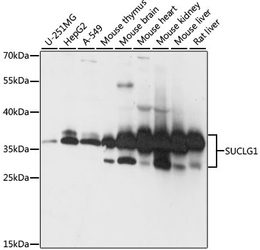 SUCLG1 Rabbit Polyclonal Antibody
