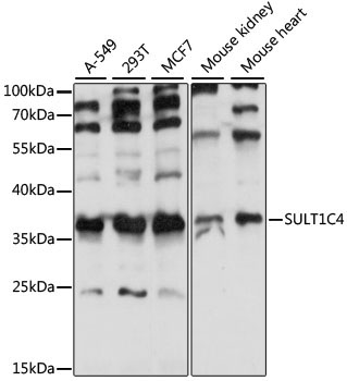 SULT1C4 Rabbit Polyclonal Antibody