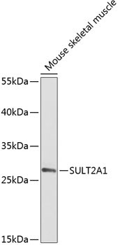 SULT2A1 Rabbit Polyclonal Antibody