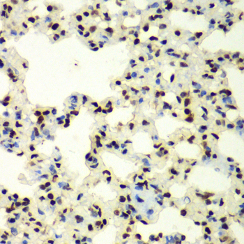 SUMO2/3 Rabbit Polyclonal Antibody - Image 2