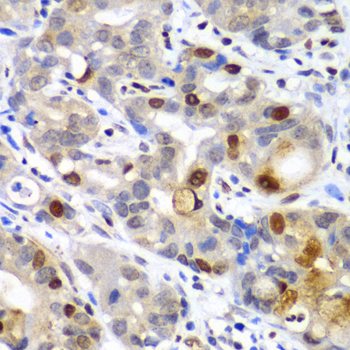 SUMO2/3 Rabbit Polyclonal Antibody - Image 3