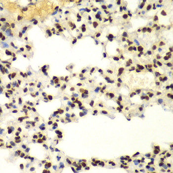 SUMO2/3 Rabbit Polyclonal Antibody - Image 4