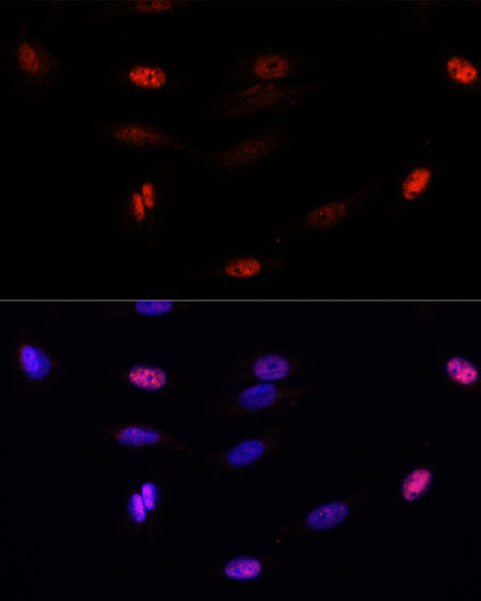 SUMO3 Rabbit Polyclonal Antibody - Image 2