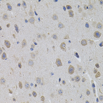 SUMO3 Rabbit Polyclonal Antibody - Image 2
