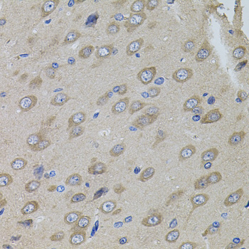 SUMO3 Rabbit Polyclonal Antibody - Image 3