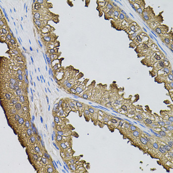 SUMO3 Rabbit Polyclonal Antibody - Image 4
