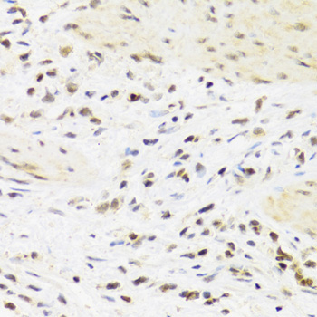 SUMO4 Rabbit Polyclonal Antibody - Image 3