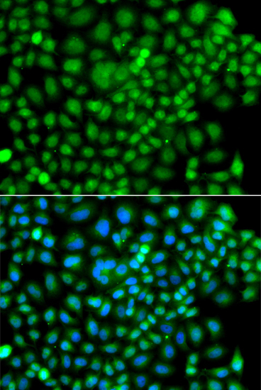 SUMO4 Rabbit Polyclonal Antibody - Image 2