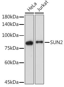 SUN2 Rabbit Monoclonal Antibody