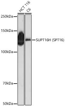 SUPT16H (SPT16) Rabbit Polyclonal Antibody