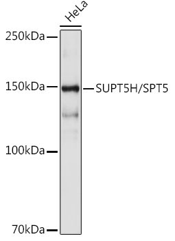 SUPT5H/SPT5 Rabbit Monoclonal Antibody