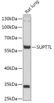 SUPT7L Rabbit Polyclonal Antibody