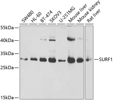 SURF1 Rabbit Polyclonal Antibody