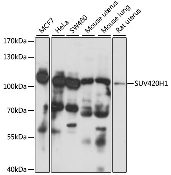 SUV420H1 Rabbit Polyclonal Antibody